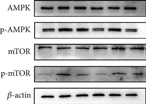 Effect Of Perk Agonist And Inhibitor On Ers Mediated Mitophagy In