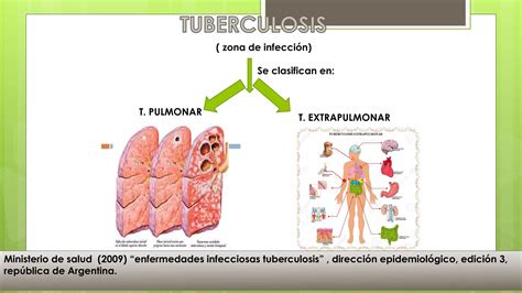 Fármacos antituberculosos PPT