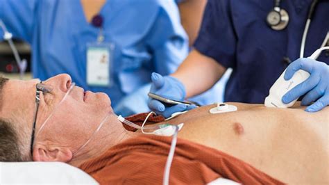 Bedside Ultrasound In The ED Philips Healthcare