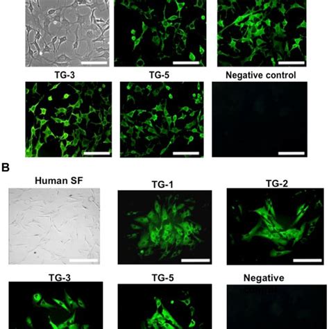 Expression Of TGs In Mouse And Human Scleral Fibroblasts A The