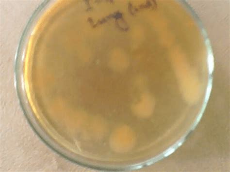 Figure 5 Mycoplasma Agar Showing Growth Of Organisms Which Is Typical