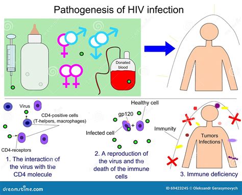 Patogênese Da Infecção Pelo HIV Ilustração do Vetor Ilustração de