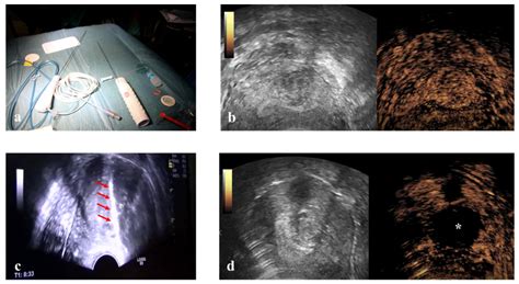 Medicina Free Full Text A Prospective Intervention Trial On