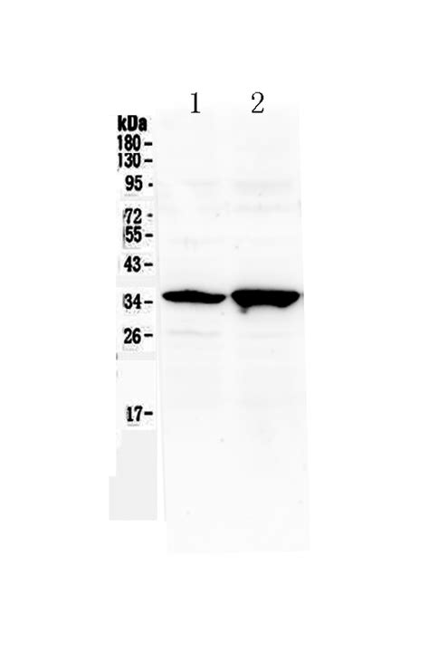 Anti Six Antibody Picoband Bosterbio