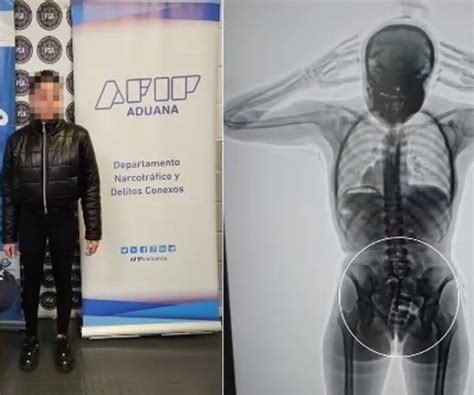 Notícias Jovem é presa após ser flagrada em aeroporto cápsulas cocaína na vagina e