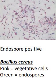 Lab 6 Endospore Stain Flashcards Quizlet