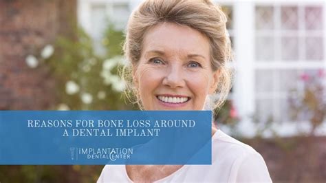 Reasons For Bone Loss Around A Dental Implant