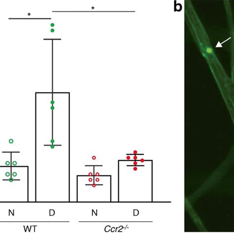 Effect Of Diabetes And The Loss Of Ccr2 On Retinal Leucostasis A