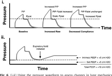 Figure 12 from Ventilator waveforms. | Semantic Scholar