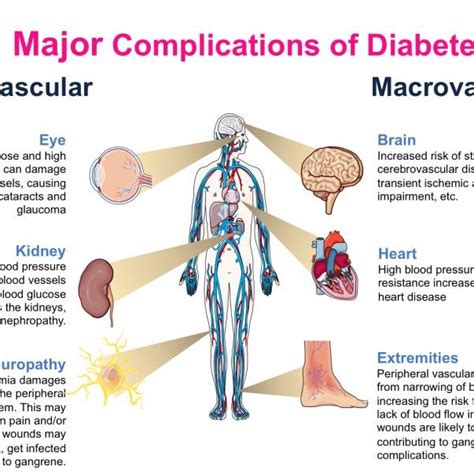 Pdf Pathophysiology Of Diabetes Mellitus