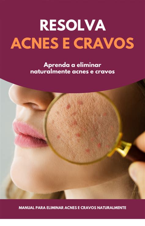 Como Eliminar Naturalmente Acnes E Cravos Maestria Shop