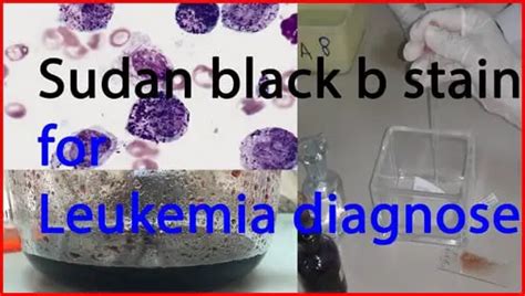 Sudan Black B Stain Purpose Principle Procedure Preparation