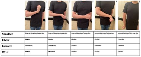 Toxins Free Full Text Canadian Physicians Use Of Intramuscular