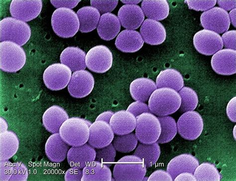 Mrsa Staph Infections What You Need To Know Student Health Care