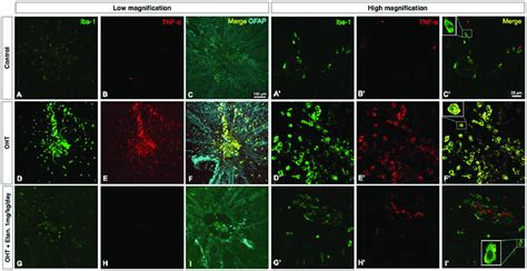 Confocal Images Of Immunofluorescent Staining For Iba Green Tnf A