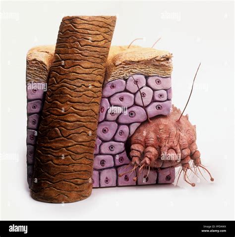 Model Of Itch Mite Sarcoptes Scabiei Burrowing Inside Human Skin