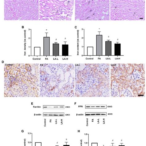 Lipoic Acid Supplementation Alleviates Iron Accumulation Caused By Fa