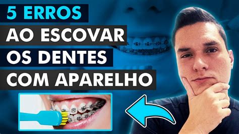 Erros Ao Escovar Os Dentes Aparelho Ortod Ntico Youtube