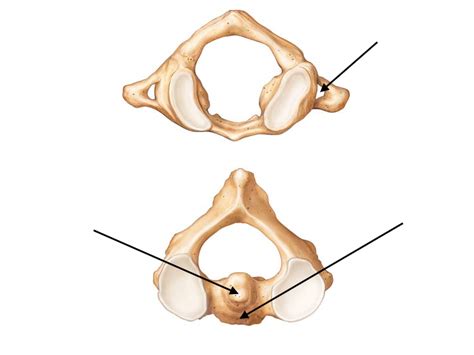 Chapter 7 C1 and C2 Vertebrae Diagram | Quizlet