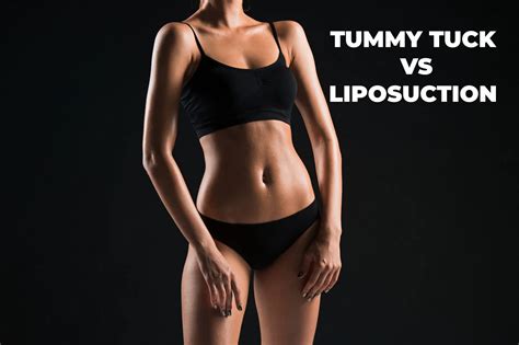 Liposuction Cost What You Need To Know Plastic Surgery In Mexico