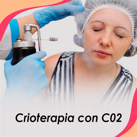 Crioterapia con CO2 Una solución efectiva para una piel saludable