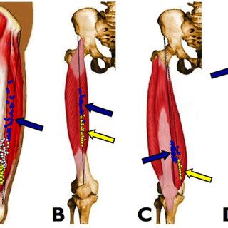 Pdf Muscle Motor Point Identification Is Essential For Optimizing