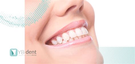 Consejos Para Lograr Unos Dientes Perfectos Clínica Dental Ybdent