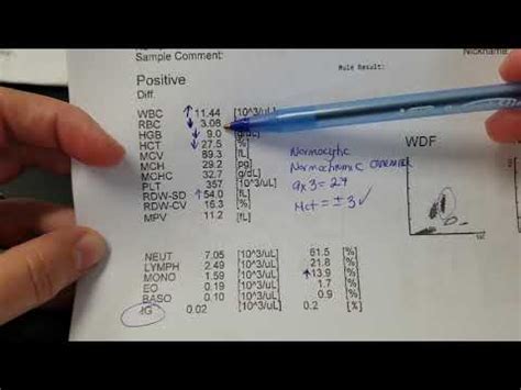 Hematology: How to interpret automated Complete Blood Count (CBC) results - YouTube