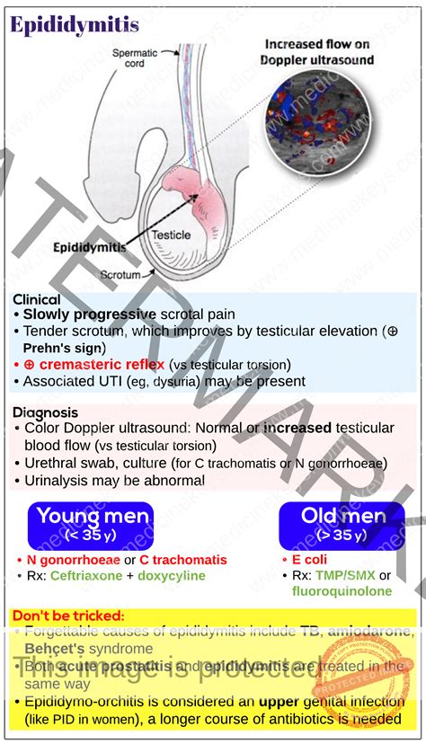 Epididymitis - Medicine Keys for MRCPs