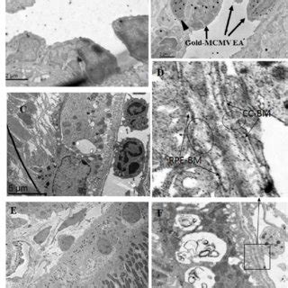 Representative Electron Microscopic Images In Eyes From Mcmv Injected