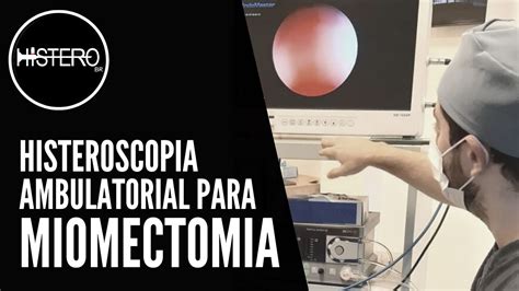 Histeroscopia Ambulatorial Para Miomectomia YouTube