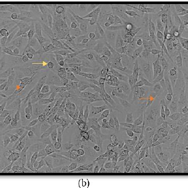 Representative Images Of Mda Mb Cells Showing A Mda Mb Cells