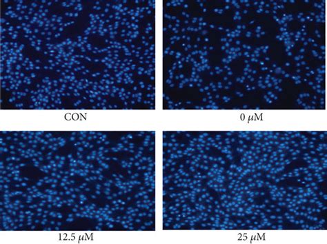 Protective Effect Of Que Against H2o2 Induced Apoptosis In Pc 12 Cells