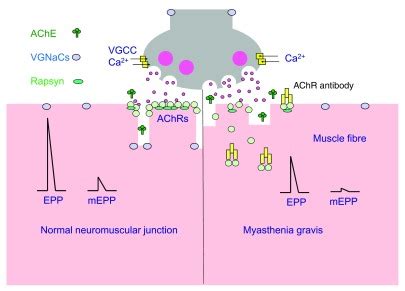 Neuromuscular Blockade Effect Of Drugs And Medical Conditions