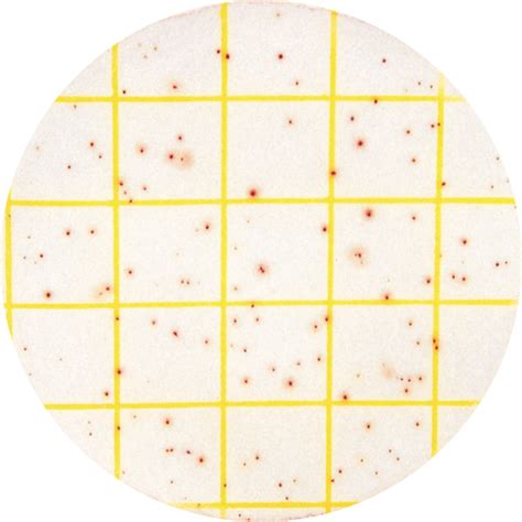 Plate Count Agar Plates Medium For Aerobic Plate Counts By The Surface