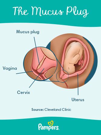 What Does It Look Like When Your Mucus Plug Comes Out