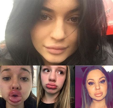 The ‘kylie Jenner Challenge Is Taking Over Social Media…and Its Gross