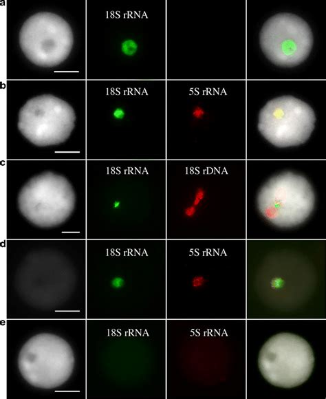 Detection Of 18s Rdnas And Transcripts From The 18s And 5s Rrna Genes