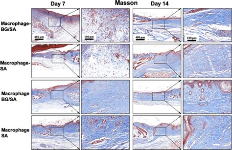 Masson Staining Of The Wounds Treated With BG SA Hydrogel Or With SA