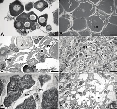 Microscopic Characteristics Of The Different Stages Of Gonadal Download Scientific Diagram