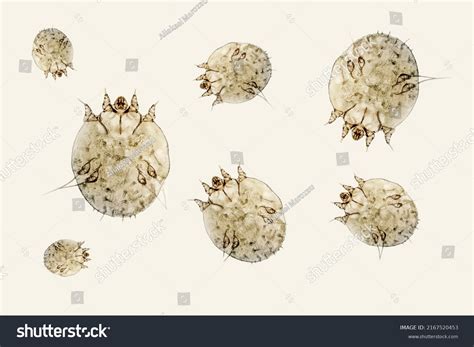 Scabies Mites