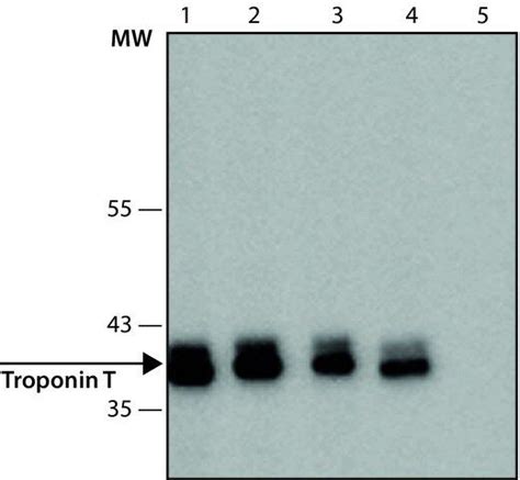 T Anti Troponin T Antibody Mouse Monoclonal