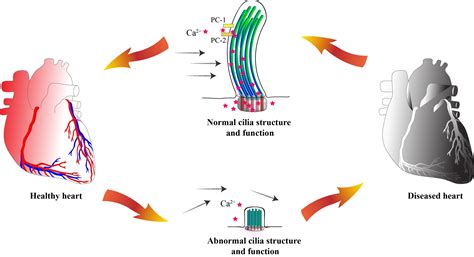 Cells Free Full Text The Roles Of Primary Cilia In Cardiovascular Diseases