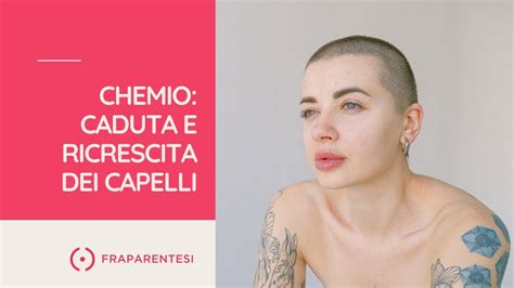 Chemioterapia Caduta E Ricrescita Dei Capelli YouTube