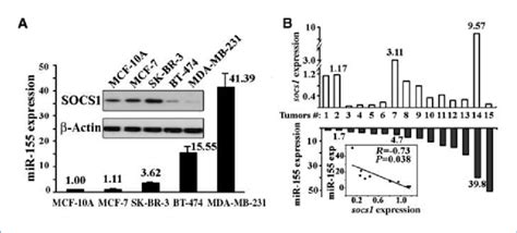 Expression Of Socs1 And Mir 155 In Breast Cancer Cells And Primary