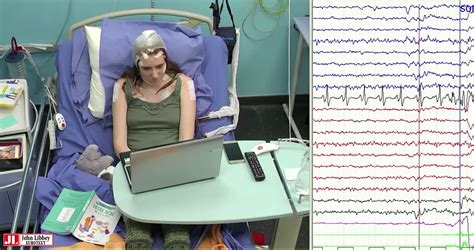 JLE Epileptic Disorders Musicogenic Epilepsy With Ictal Asystole A