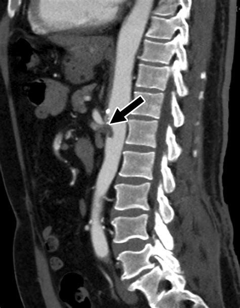 Multisystem Imaging Manifestations Of Covid Part Viral