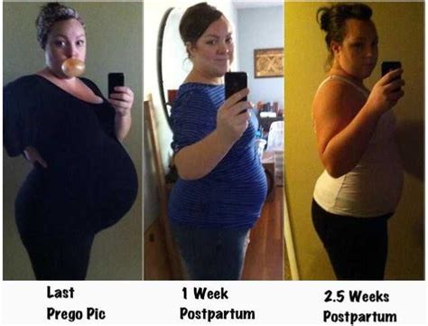 5 Weeks Postpartum Weight Loss WeightLossLook