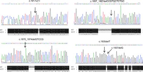 Dna Sequence Chromatograms Demonstrating Asxl1 Mutations With