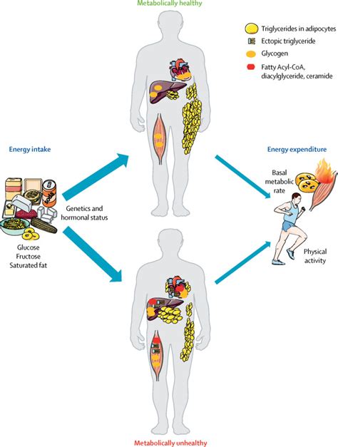 Causes Consequences And Treatment Of Metabolically Unhealthy Fat